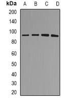 MDM2 Antibody (Internal)