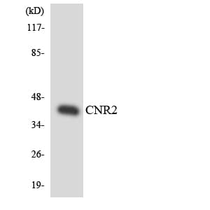 CNR2 / CB2 Antibody (aa285-334)