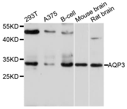 Polyclonal Rabbit anti-Human AQP3 / Aquaporin 3 Antibody (IHC, WB)