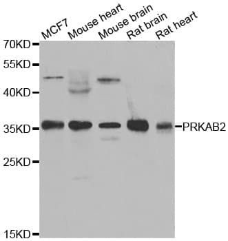 PRKAB2 / AMPK Beta 2 Antibody