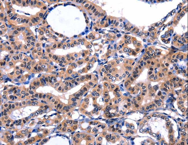 FBN1 / Fibrillin 1 Antibody