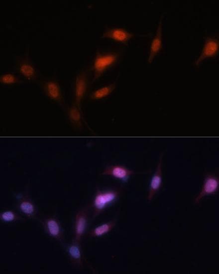 SIRT1 / Sirtuin 1 Antibody
