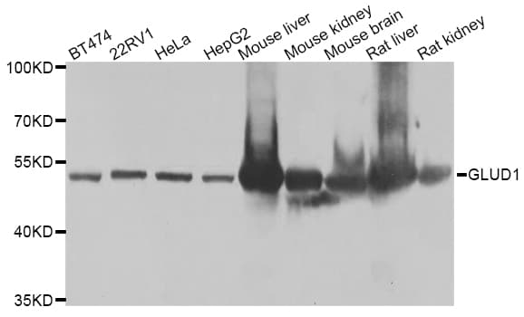 Polyclonal Rabbit anti-Human GLUD1/Glutamate Dehydrogenase Antibody (IHC, WB)