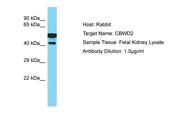 Polyclonal Rabbit anti-Human CBWD2 Antibody (aa278-327, WB)