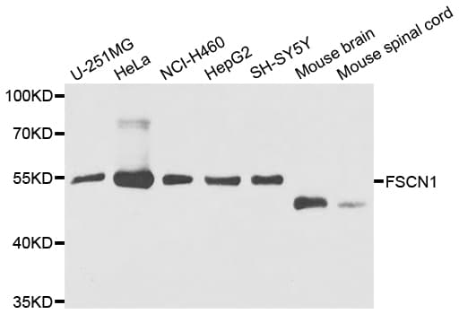 IHC-plus™ Polyclonal Rabbit anti-Human FSCN1 / Fascin Antibody (IHC, WB)