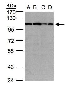 IHC-plus™ ACTN2 Antibody