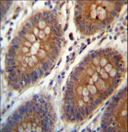 TRIM38 Antibody (aa423-451)