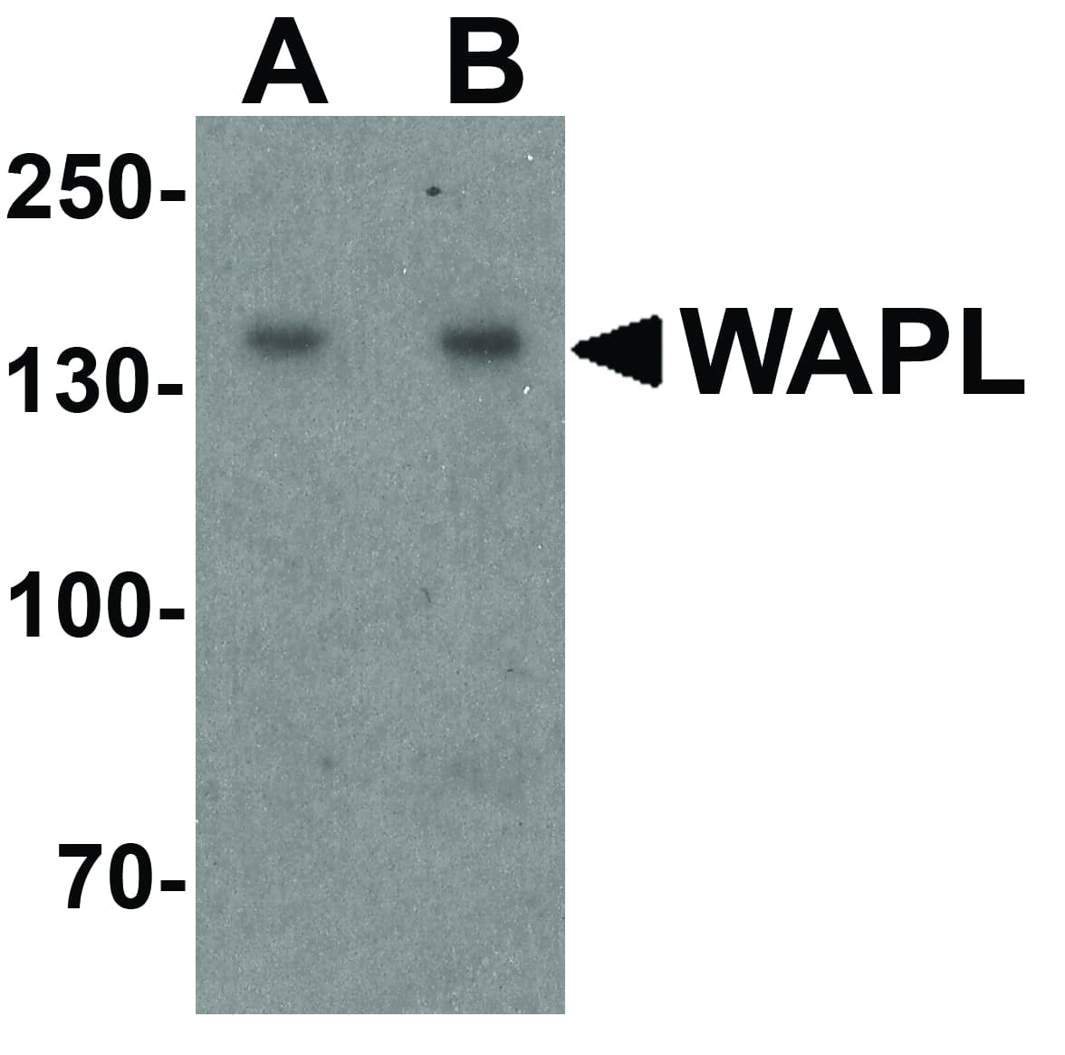 WAPAL / WAPL Antibody