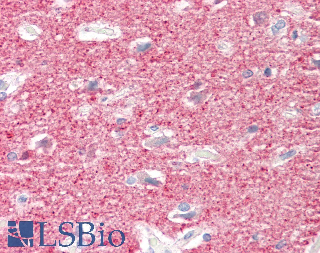 IHC-plus™ MEF2B Antibody (aa51-100)