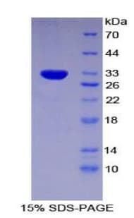 Mouse FOXO1 / FKHR Protein (Recombinant His-T7)
