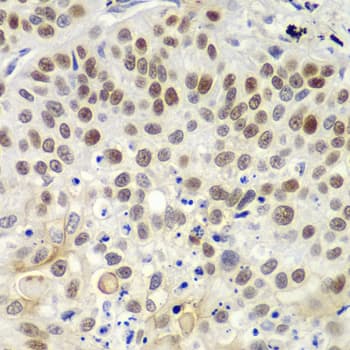 Polyclonal Rabbit anti-Human MSH6 Antibody (IHC, IF, WB)