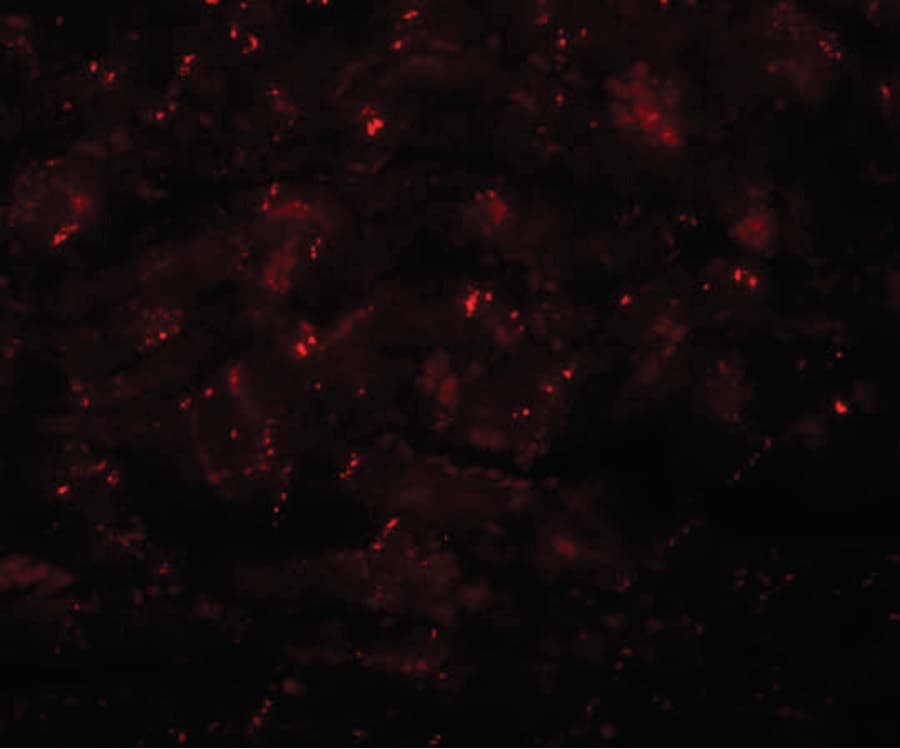 IHC-plus™ CCDC47 Antibody