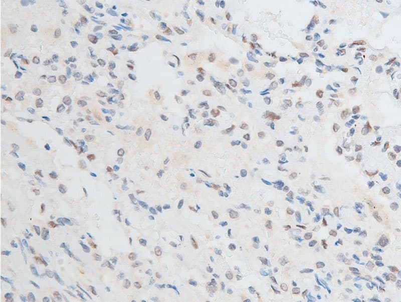 CHEK2 / CHK2 Antibody (phospho-Thr387)