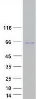 Human TSEN2 Protein (Recombinant Myc-DDK (Flag))