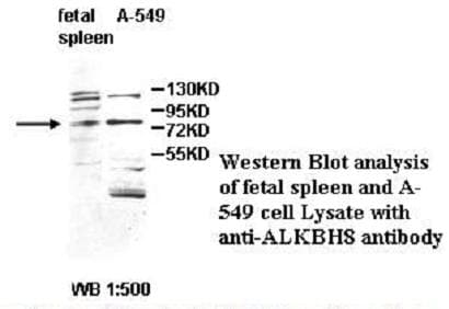 ALKBH8 Antibody (aa2-238)