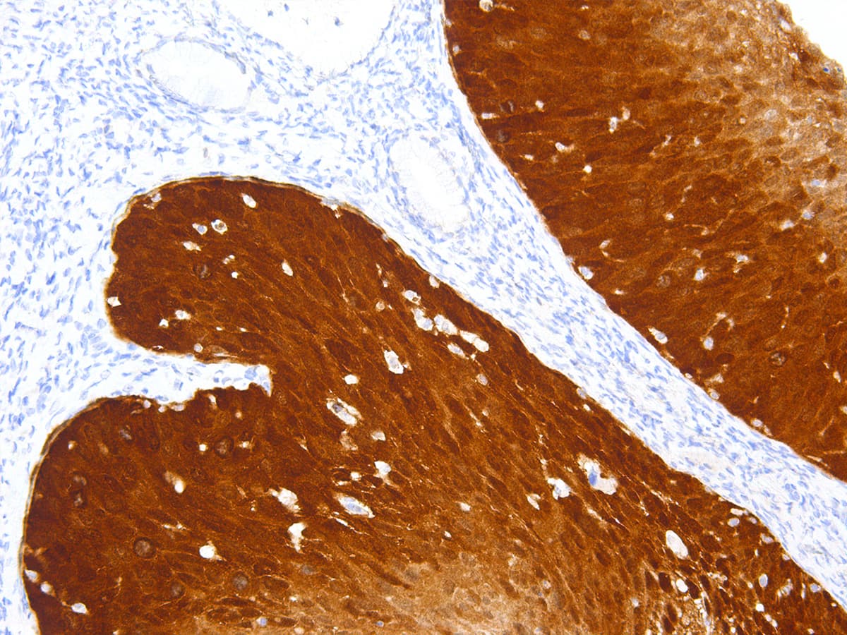 PathPlus™ p16INK4a / CDKN2A Antibody (Concentrated)