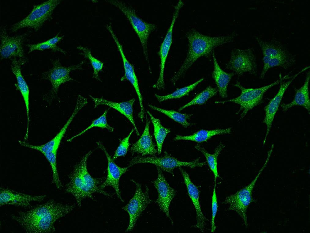 FAM175B / KIAA0157 Antibody