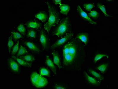 PLK1 / PLK-1 Antibody