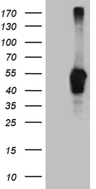 LHX2 Antibody (aa220-406, clone OTI4E6, Carrier-free)