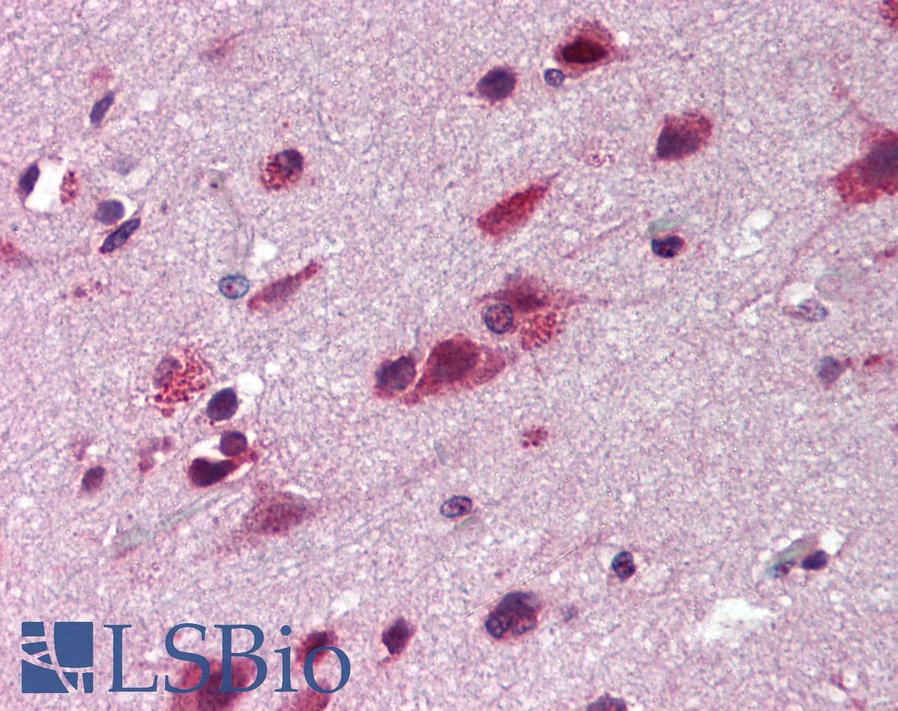 IHC-plus™ TNIP2 / ABIN-2 Antibody