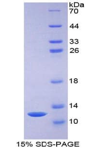 Rat CCL7 / MCP3 Protein (Recombinant His-T7)