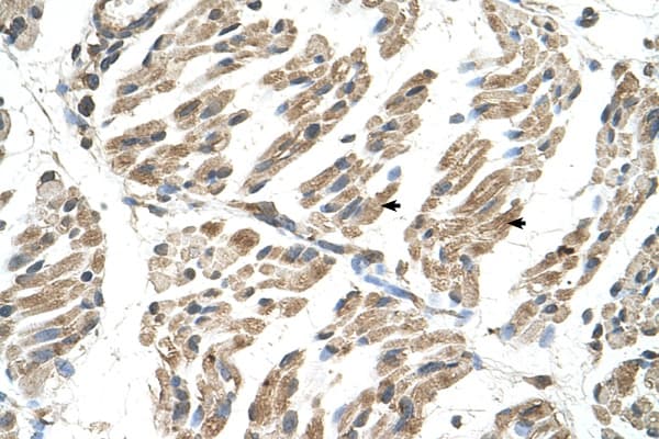 SLC6A8 Antibody (aa200-249, FITC)