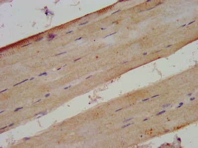 Polyclonal Rabbit anti-Human XIRP2 Antibody (IHC)