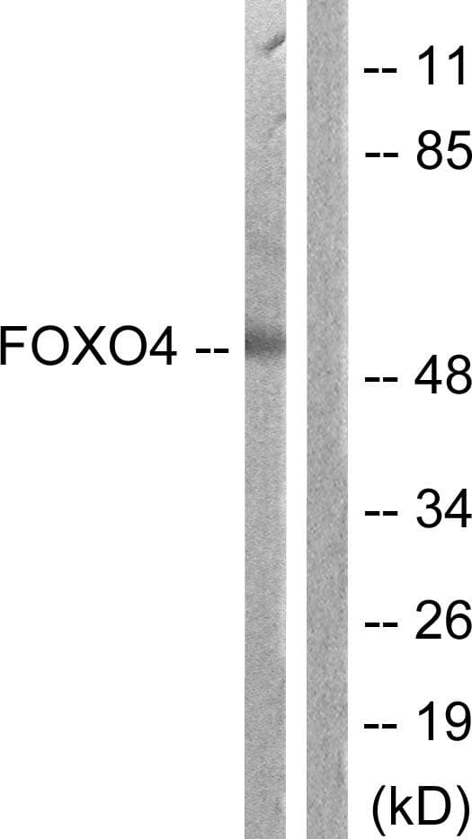 FOXO4 / AFX1 Antibody (p451)