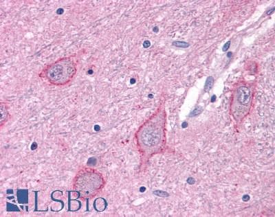 PathPlus™ GRM3 / MGLUR3 Antibody (N-Terminus)