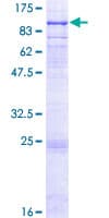 Human GALNT6 Protein (Recombinant GST)