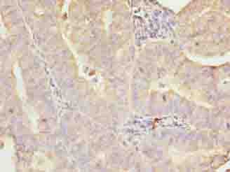 GALNT7 Antibody