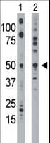 ETNK1 / Ethanolamine Kinase 2 Antibody (aa1-30)