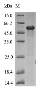 Aspergillus fumigatus AFUA_2G03830 Protein (Recombinant 6His-SUMO, N-terminus)