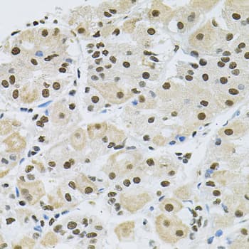 Polyclonal Rabbit anti-Human MAPK8 / JNK1 Antibody (IHC, IF, WB)