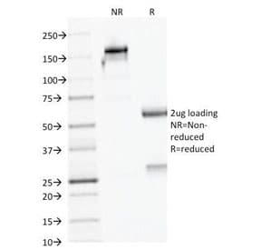 AMACR / P504S Antibody (clone AMACR/1723)