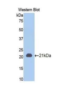 TNFRSF1A / TNFR1 Antibody (aa43-194)