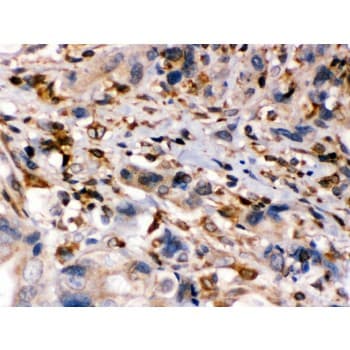 ABCB2 / TAP1 Antibody (aa438-471)