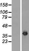 FBL / FIB / Fibrillarin Protein (Over-Expression Lysate Myc-DDK (Flag))