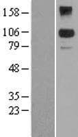 BACH2 Protein (Over-Expression Lysate Myc-DDK (Flag))