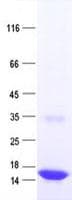 Human STH Protein (Recombinant His, N-Terminal)