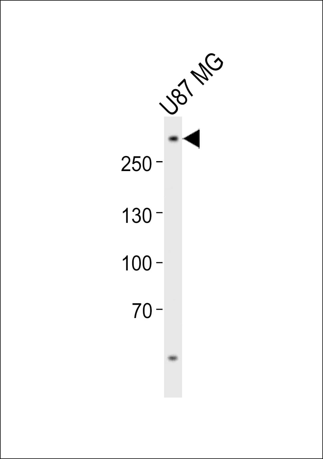 ABCA2 Antibody (aa1339-1373)