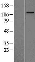 Human MCM2 Protein (Over-Expression Lysate Myc-DDK (Flag))