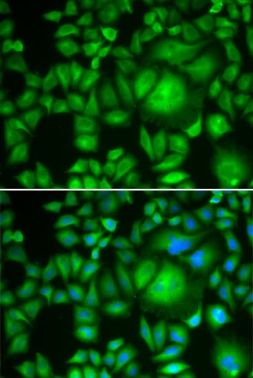 Polyclonal Rabbit anti-Human CBR / CBR1 Antibody (IHC, IF, WB)