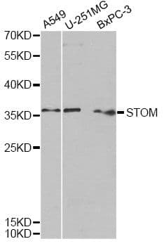 STOM / Stomatin Antibody