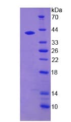 Human DTNBP1 / Dysbindin Protein (Recombinant His, N-Terminal)