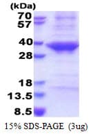 Human CTSE / Cathepsin E Protein (Recombinant His)