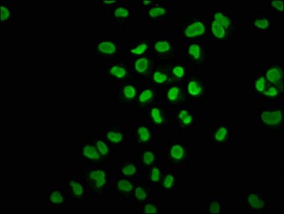 Polyclonal Rabbit anti-Human HIST1H3A Antibody (IHC, WB)
