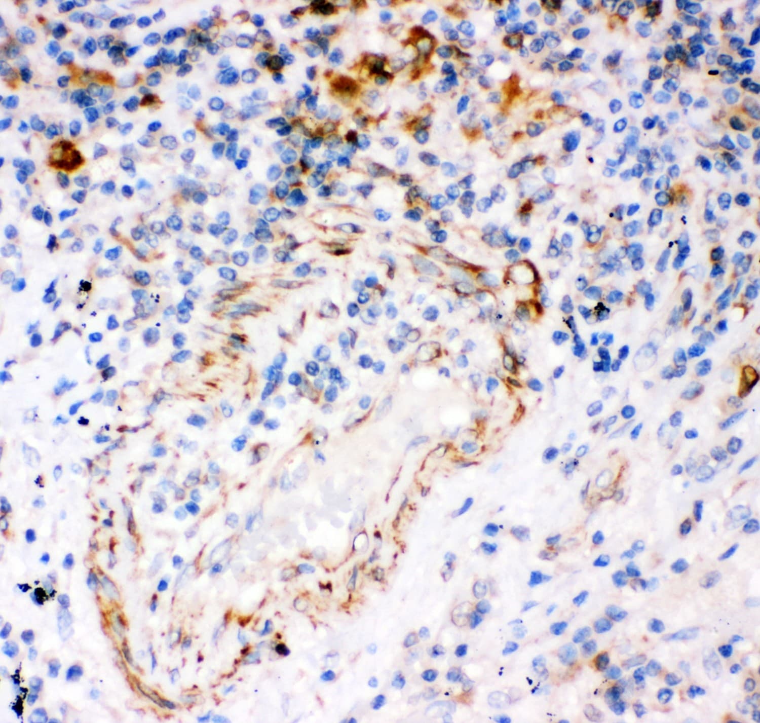 Polyclonal Rabbit anti-Human ITPR1 / IP3 Receptor Type 1 Antibody (aa2411-2758, IHC, WB)