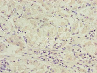 Polyclonal Rabbit anti-Human SLC52A1 / GPR172B / PAR2 Antibody (IHC)