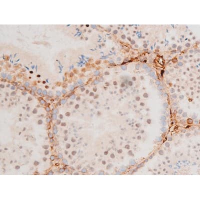 Polyclonal Rabbit anti-Human GATA4 Antibody (phospho-Ser262, IHC, IF, WB)